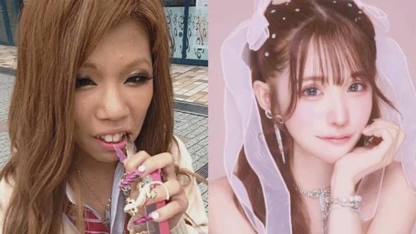 淘股神 日本女子干8年苦力攒2600万整容换头！直言可爱的脸比铂金包珍贵，年轻就是最强武器！